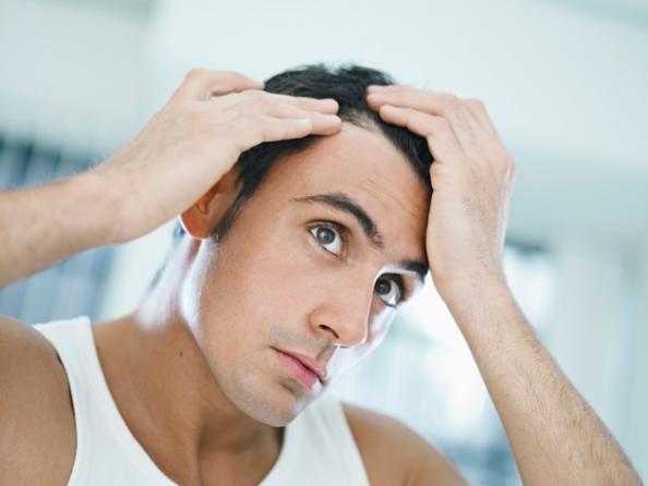 Understanding and Preventing Hair Loss